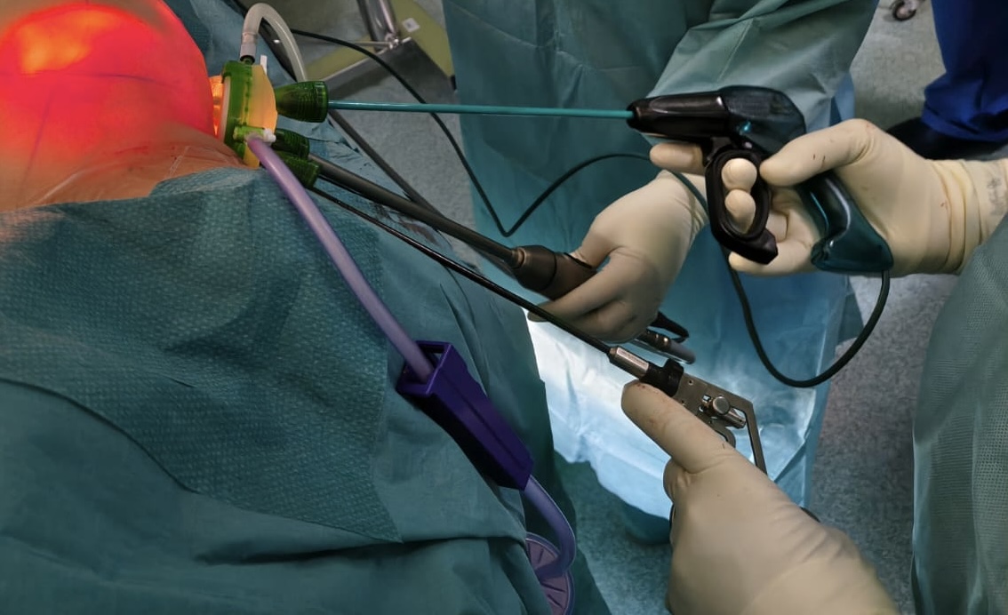 Chirurgia senologica mininvasiva grazie all'introduzione della mastectomia endoscopica