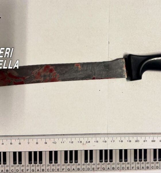 Accoltella un conoscente al volto e alla gamba: arrestato