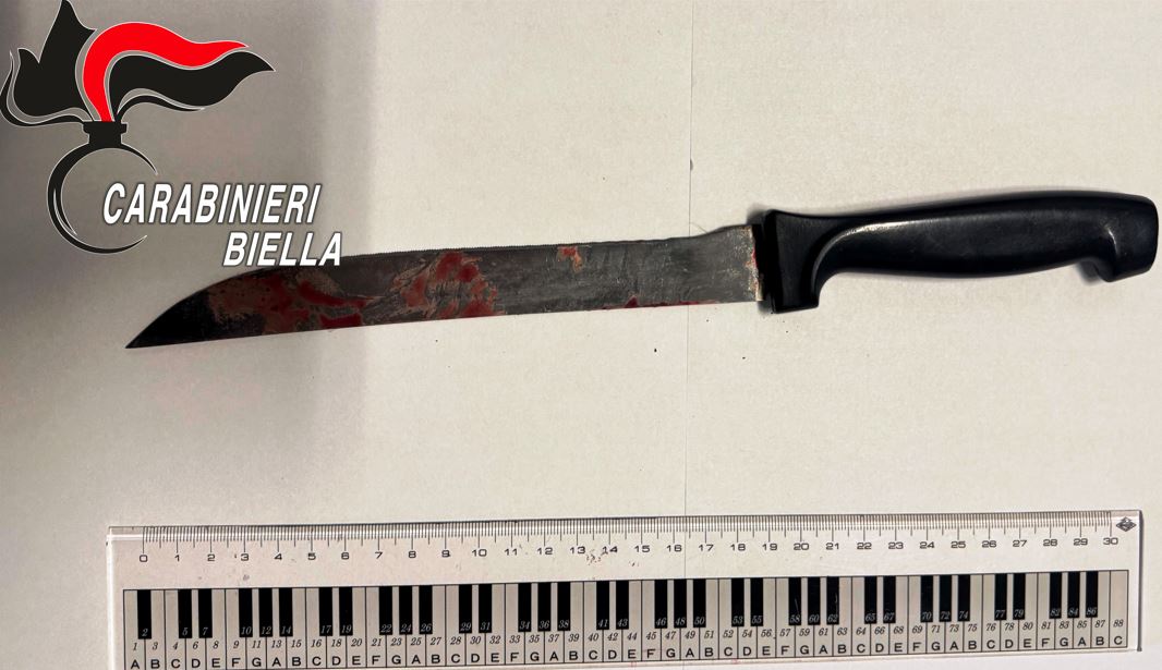 Accoltella un conoscente al volto e alla gamba: arrestato